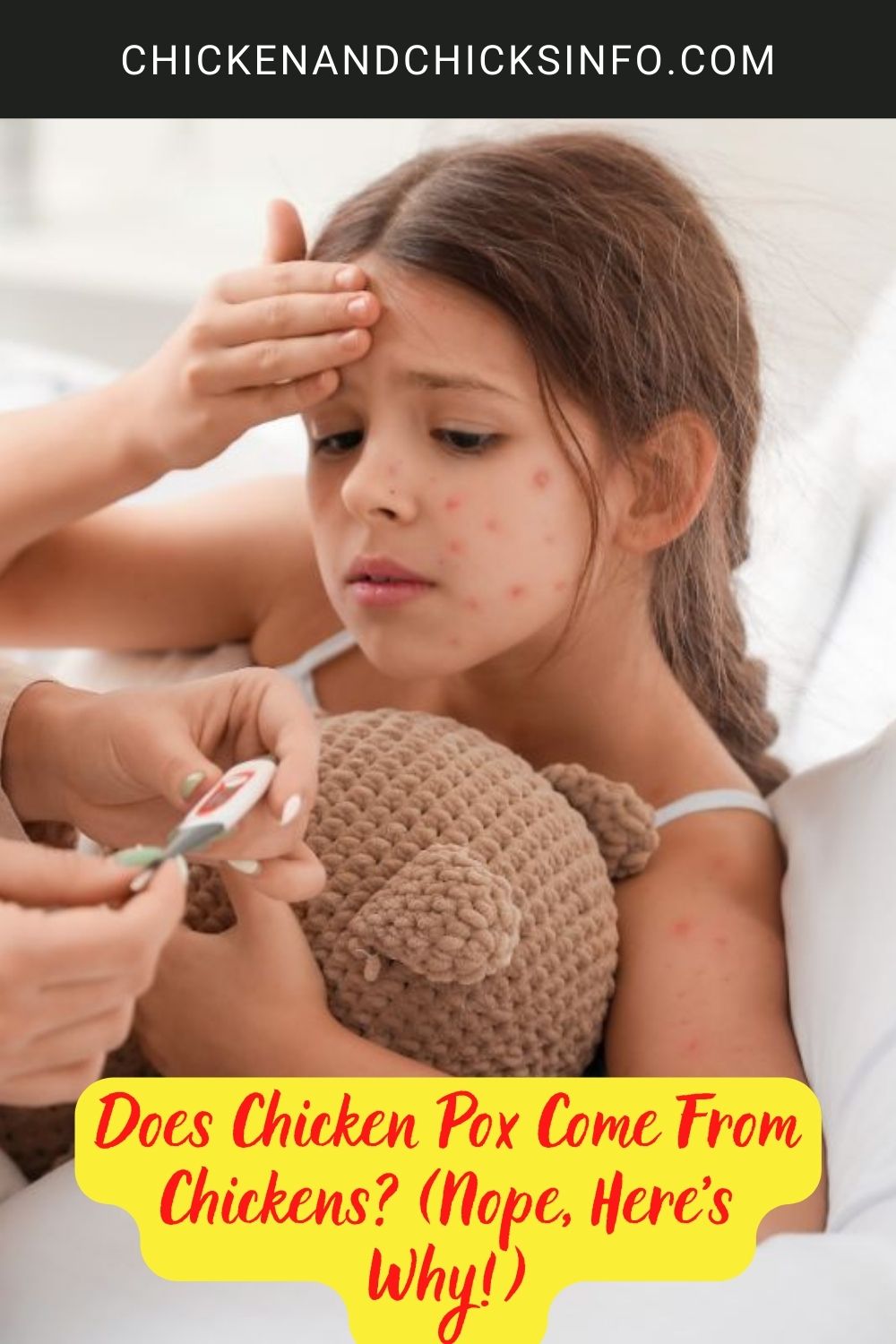 Does Chicken Pox Come From Chickens? (Nope, Here's Why!) poster.